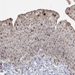NSMCE4A Antibody, Novus Biologicals:Antibodies:Primary Antibodies