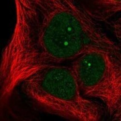 NSP 5 alpha 3 alpha Rabbit anti-Human, Polyclonal, Novus Biologicals 100