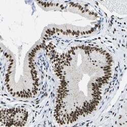 NSRP1 Antibody, Novus Biologicals 0.1mL; Unlabeled:Antibodies, Polyclonal