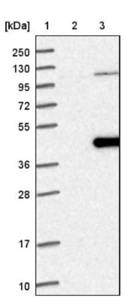 NSUN3 Antibody, Novus Biologicals:Antibodies:Primary Antibodies
