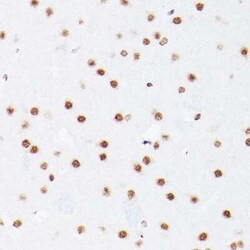 NSUN5 Rabbit anti-Human, Mouse, Rat, Polyclonal, Novus Biologicals 20 &mu;g | Buy Online | Novus Biologicals | Fisher Scientific