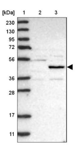NSUN5 Antibody, Novus Biologicals 0.1mL; Unlabeled:Antibodies, Polyclonal