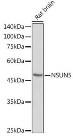 NSUN5 Rabbit anti-Human, Mouse, Rat, Polyclonal, Novus Biologicals 20 &mu;g | Buy Online | Novus Biologicals | Fisher Scientific
