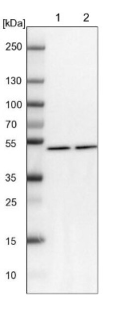NSUN6 Antibody, Novus Biologicals 0.1 mL | Buy Online | Novus Biologicals | Fisher Scientific