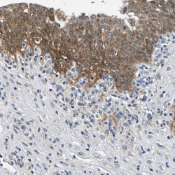 NT5C Antibody, Novus Biologicals 0.1mL; Unlabeled:Antibodies, Polyclonal