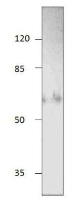 NT5C2 Antibody, Novus Biologicals 100 &mu;g | Buy Online | Novus Biologicals | Fisher Scientific