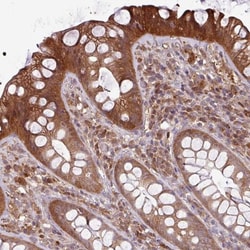 NT5C3 Antibody, Novus Biologicals:Antibodies:Primary Antibodies