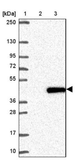 NT5C3 Antibody, Novus Biologicals:Antibodies:Primary Antibodies