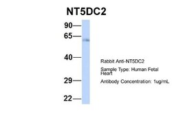 NT5DC2 Antibody, Novus Biologicals:Antibodies:Primary Antibodies