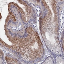 NTF2 Antibody, Novus Biologicals 0.1mL; Unlabeled:Antibodies, Polyclonal