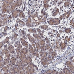 NTF2 Antibody, Novus Biologicals 0.1mL; Unlabeled:Antibodies, Polyclonal