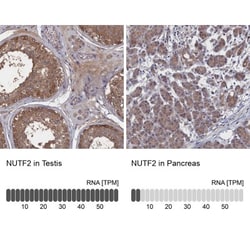 NTF2 Antibody, Novus Biologicals 0.1mL; Unlabeled:Antibodies, Polyclonal