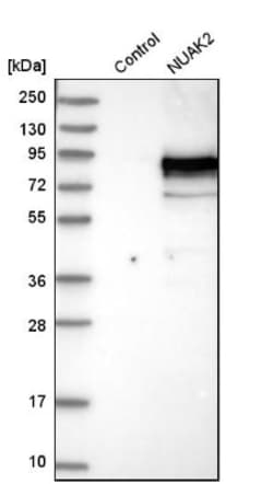 NUAK2 Antibody, Novus Biologicals 25 &mu;L | Buy Online | Novus Biologicals | Fisher Scientific