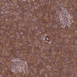 NUBP1 Antibody, Novus Biologicals 0.1mL; Unlabeled:Antibodies, Polyclonal