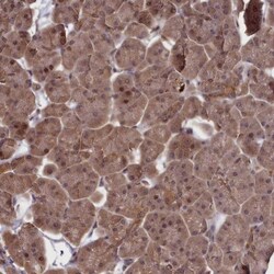NUBP1 Antibody, Novus Biologicals 25 &mu;L | Buy Online | Novus Biologicals | Fisher Scientific
