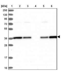 NUBP1 Antibody, Novus Biologicals 0.1mL; Unlabeled:Antibodies, Polyclonal