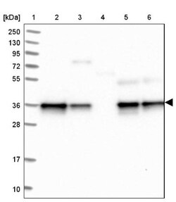 NUBP1 Antibody, Novus Biologicals 25 &mu;L | Buy Online | Novus Biologicals | Fisher Scientific