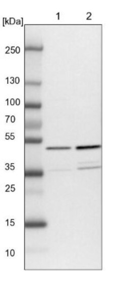 NUDC Antibody, Novus Biologicals 25 &mu;L | Buy Online | Novus Biologicals | Fisher Scientific