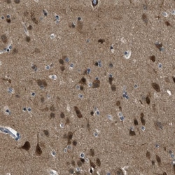 NUDCD3 Antibody, Novus Biologicals 0.1mL; Unlabeled:Antibodies, Polyclonal