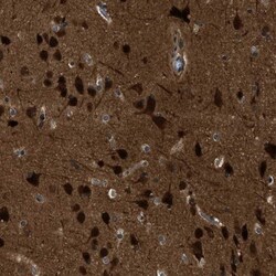 NUDCD3 Antibody, Novus Biologicals:Antibodies:Primary Antibodies