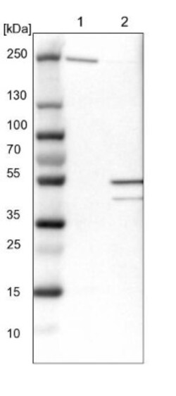 NUDCD3 Antibody, Novus Biologicals 0.1mL; Unlabeled:Antibodies, Polyclonal