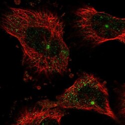 NUDT17 Antibody, Novus Biologicals 0.1mL; Unlabeled:Antibodies, Polyclonal