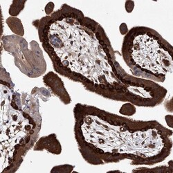 NUDT17 Antibody, Novus Biologicals 0.1mL; Unlabeled:Antibodies, Polyclonal