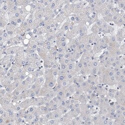NUDT17 Antibody, Novus Biologicals 0.1mL; Unlabeled:Antibodies, Polyclonal