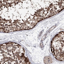 NUDT17 Antibody, Novus Biologicals 0.1mL; Unlabeled:Antibodies, Polyclonal