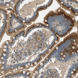 NUDT4 Antibody, Novus Biologicals 0.1mL; Unlabeled:Antibodies, Polyclonal