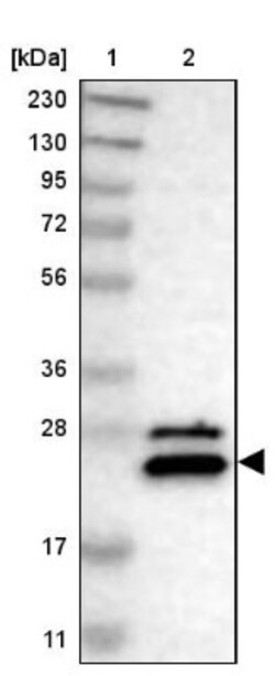 NUDT4 Antibody, Novus Biologicals 0.1mL; Unlabeled:Antibodies, Polyclonal