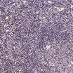 NUDT8 Antibody, Novus Biologicals 25 &mu;L; Unlabeled:Antibodies, Polyclonal