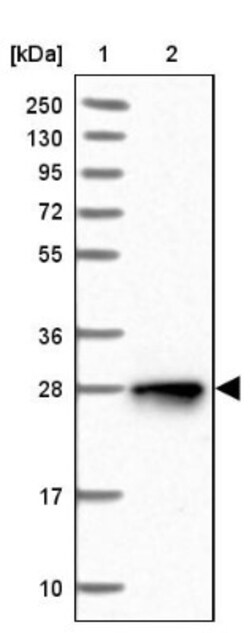 NUDT8 Antibody, Novus Biologicals 25 &mu;L; Unlabeled:Antibodies, Polyclonal