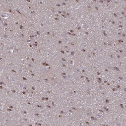 NUMBL Antibody, Novus Biologicals 25 &mu;L, Unlabeled:Antibodies, Polyclonal