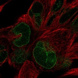 NUP133 Antibody, Novus Biologicals 0.1mL; Unlabeled:Antibodies, Polyclonal