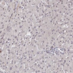NUP155 Antibody, Novus Biologicals 25 &mu;L | Buy Online | Novus Biologicals | Fisher Scientific