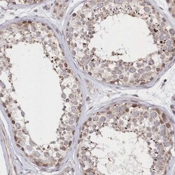 NUP155 Antibody, Novus Biologicals 25 &mu;L | Buy Online | Novus Biologicals | Fisher Scientific