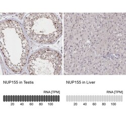 NUP155 Antibody, Novus Biologicals 25 &mu;L | Buy Online | Novus Biologicals | Fisher Scientific