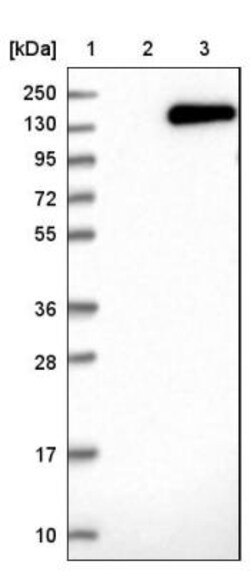 NUP155 Antibody, Novus Biologicals 25 &mu;L | Buy Online | Novus Biologicals | Fisher Scientific