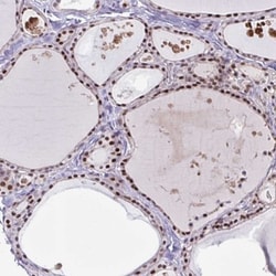 NUP188 Antibody, Novus Biologicals:Antibodies:Primary Antibodies