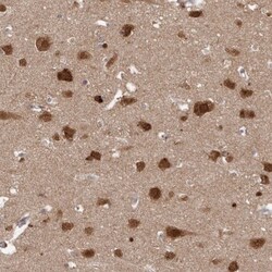 NUP43 Antibody, Novus Biologicals 0.1mL; Unlabeled:Antibodies, Polyclonal