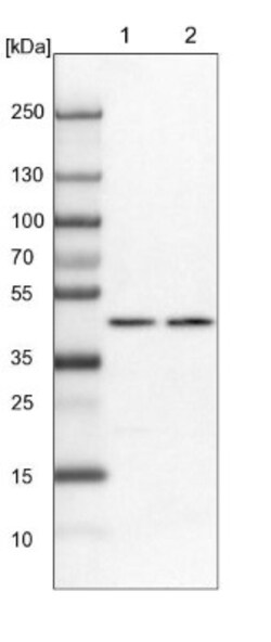 NUP43 Antibody, Novus Biologicals 0.1mL; Unlabeled:Antibodies, Polyclonal
