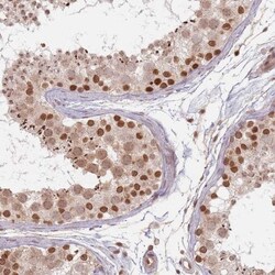 NUP50 Antibody, Novus Biologicals 0.1mL; Unlabeled:Antibodies, Polyclonal