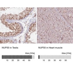 NUP50 Antibody, Novus Biologicals 0.1mL; Unlabeled:Antibodies, Polyclonal