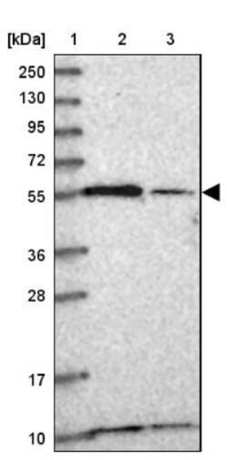 NUP50 Antibody, Novus Biologicals 0.1mL; Unlabeled:Antibodies, Polyclonal