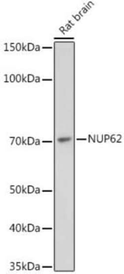 NUP62 Rabbit anti-Human, Mouse, Rat, Clone: 4V10S5, Novus Biologicals 100