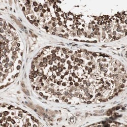 NUP62 Antibody, Novus Biologicals 25 &mu;L; Unlabeled:Antibodies, Polyclonal