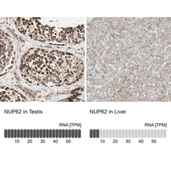 NUP62 Antibody, Novus Biologicals 25 &mu;L; Unlabeled:Antibodies, Polyclonal