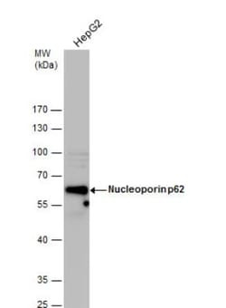 NUP62 Antibody, Novus Biologicals 0.1mg; Unlabeled:Antibodies, Polyclonal
