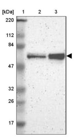 NUP62 Antibody, Novus Biologicals 25 &mu;L; Unlabeled:Antibodies, Polyclonal